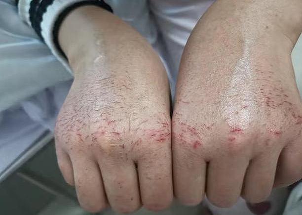 武汉封城第27天，确诊7万，死亡冲破2000人：疫情当前，这件事比戴口罩更重要！（组图） - 9