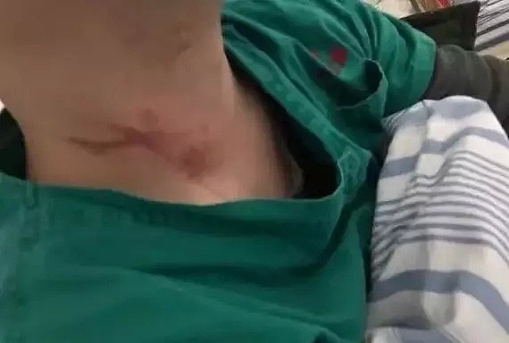武汉封城第27天，确诊7万，死亡冲破2000人：疫情当前，这件事比戴口罩更重要！（组图） - 12