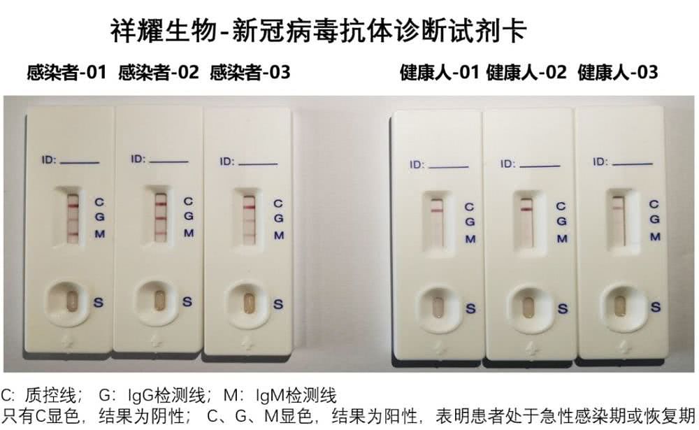采一滴血，十分钟检出！中国成功研制新冠病毒快速诊断试剂盒（组图） - 1