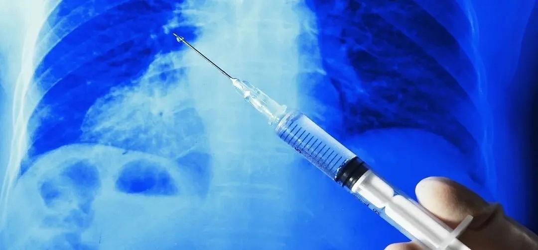 喜讯！首批新冠肺炎人体疫苗来了，已开启安全性临床试验！（组图） - 3