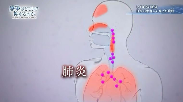 日本电视台模拟家庭传染，做到这个比戴口罩更能阻挡病毒！（组图） - 10