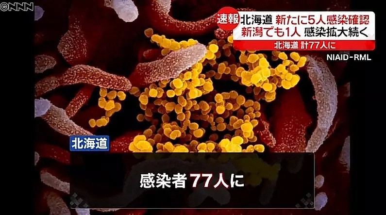 日本迎来“最惨樱花季”，感染者逼近1000人，而中国援助及时送到......（组图） - 10