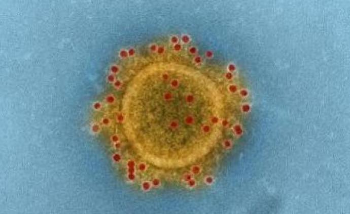 巴西对2例新冠肺炎病毒测序：与在中国发现的病毒不同！（组图） - 1