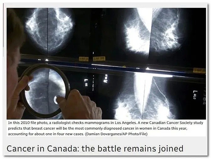 OMG！加拿大一半人口，会被查出这种病！这才是致死率最高病症，发病原因竟是它...（组图） - 6