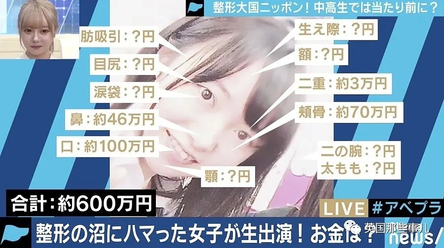 19岁少女两年花600万整成网红脸…网友翻出她的旧照，惊呆了...（组图） - 17