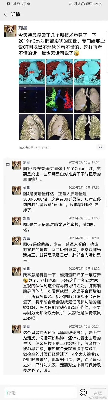 意大利医生崩溃：几乎整整一代人都被病毒带走了！肺炎不幸，而更不幸的却是...（组图） - 21