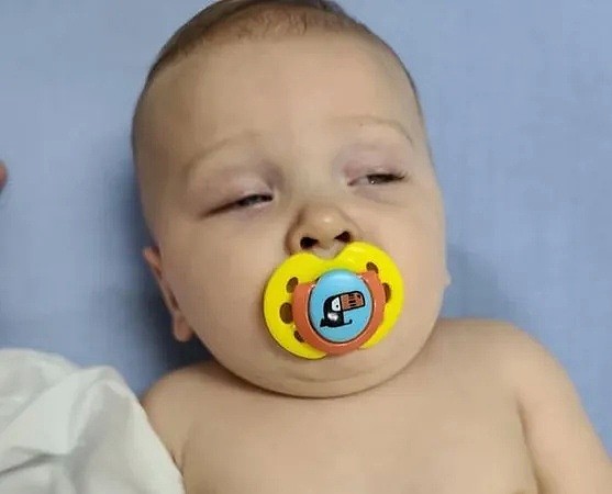7月大男婴发烧确诊！成美国最年轻患者，孩子妈妈绝望曝感染过程（组图） - 1