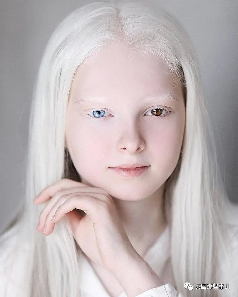【美女】一眼冰雪，一眼森林…这个白化病+异色瞳的俄罗斯少女让网友震惊了（组图） - 2