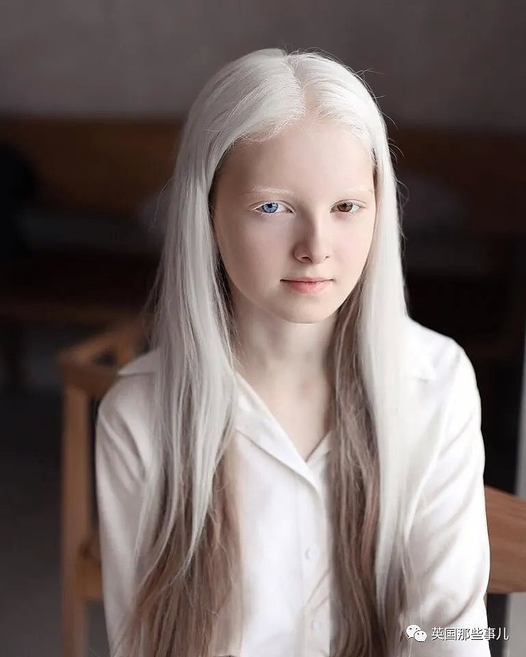 【美女】一眼冰雪，一眼森林…这个白化病+异色瞳的俄罗斯少女让网友震惊了（组图） - 3