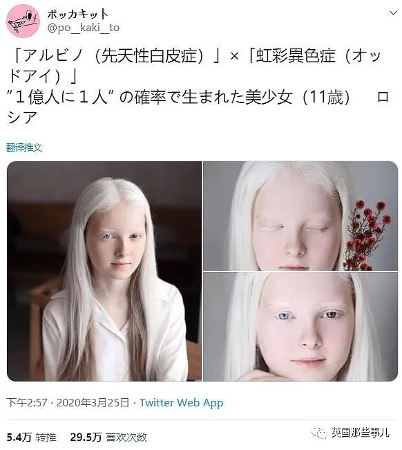 【美女】一眼冰雪，一眼森林…这个白化病+异色瞳的俄罗斯少女让网友震惊了（组图） - 6