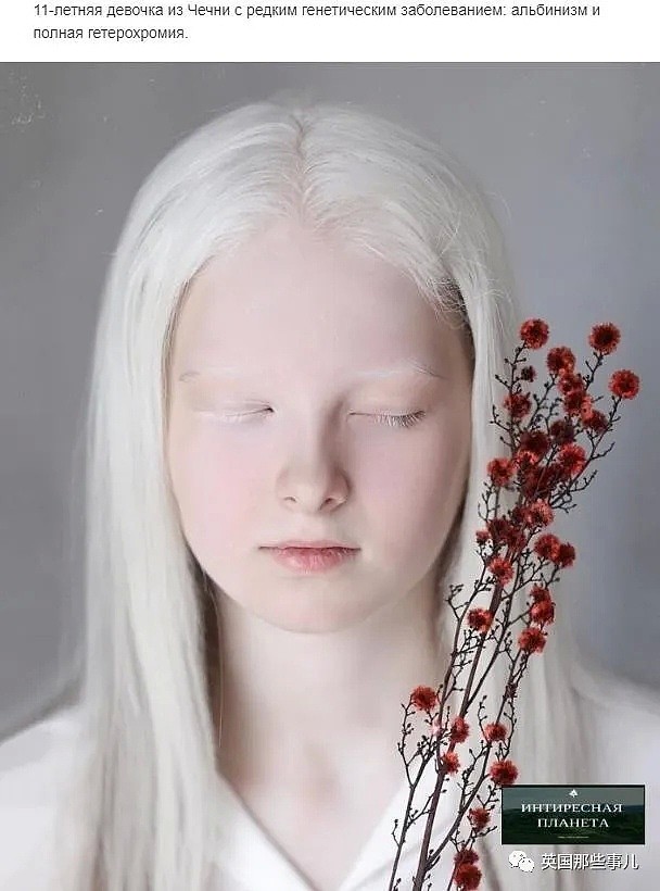 【美女】一眼冰雪，一眼森林…这个白化病+异色瞳的俄罗斯少女让网友震惊了（组图） - 1