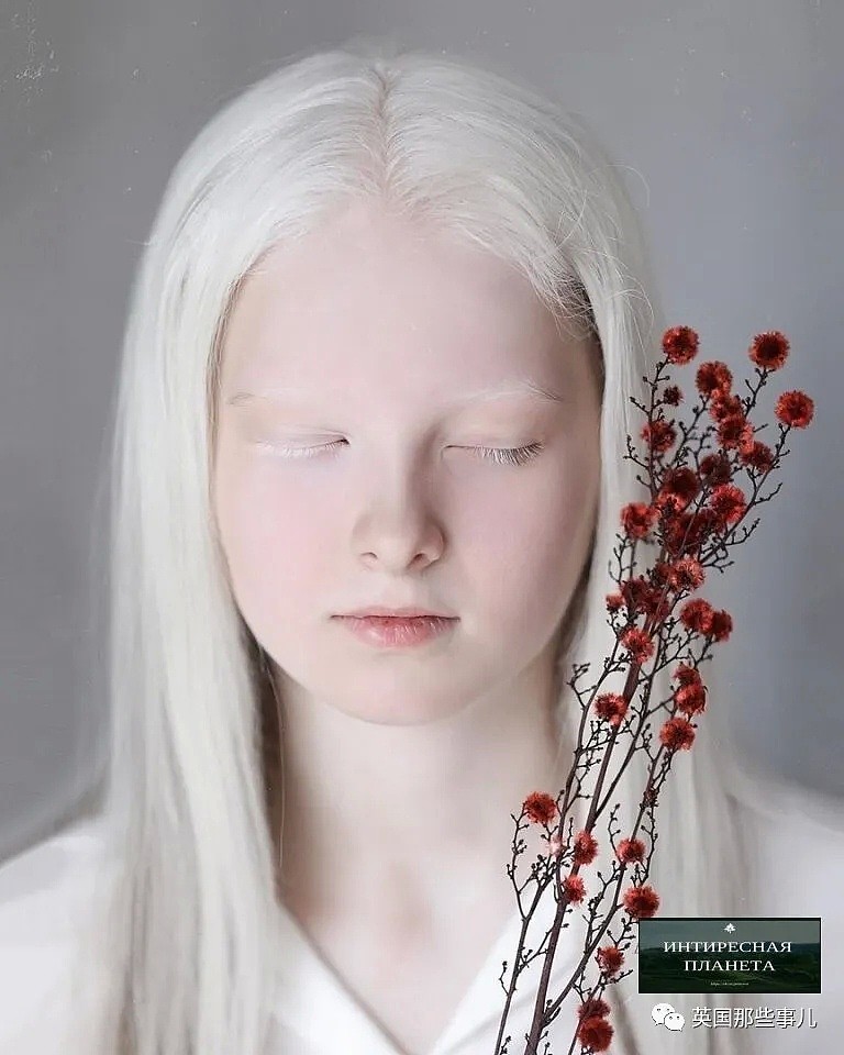 【美女】一眼冰雪，一眼森林…这个白化病+异色瞳的俄罗斯少女让网友震惊了（组图） - 7