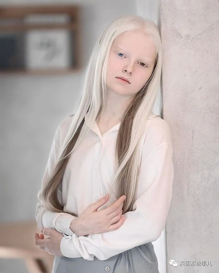 【美女】一眼冰雪，一眼森林…这个白化病+异色瞳的俄罗斯少女让网友震惊了（组图） - 8