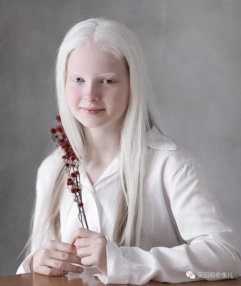 【美女】一眼冰雪，一眼森林…这个白化病+异色瞳的俄罗斯少女让网友震惊了（组图） - 9