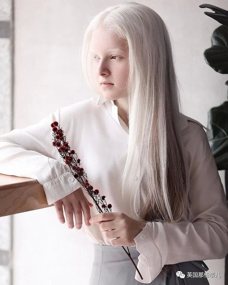【美女】一眼冰雪，一眼森林…这个白化病+异色瞳的俄罗斯少女让网友震惊了（组图） - 17
