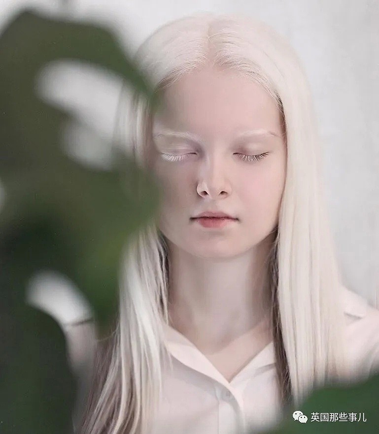 【美女】一眼冰雪，一眼森林…这个白化病+异色瞳的俄罗斯少女让网友震惊了（组图） - 18