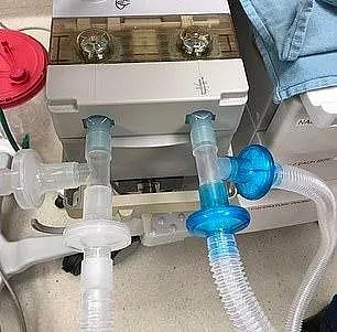点赞！加拿大天才医生改造呼吸机，一台能供9名患者使用！（组图） - 4