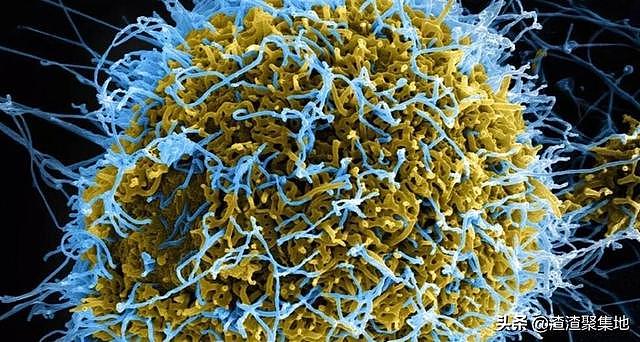 东非出现神秘X病毒, 症状与埃博拉相似, 已有2000人死亡