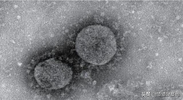 东非出现神秘X病毒, 症状与埃博拉相似, 已有2000人死亡