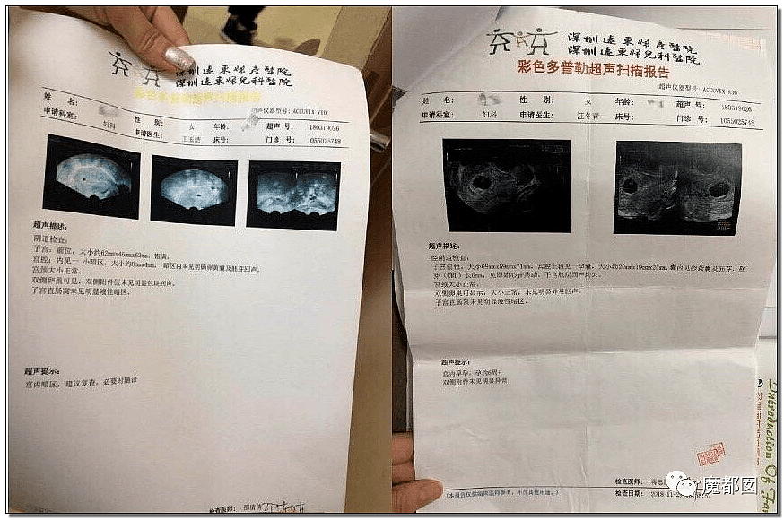 出轨堕胎？人设巨崩？偶像巨星嘉羿和孔雪儿被前女友爆锤（组图） - 30