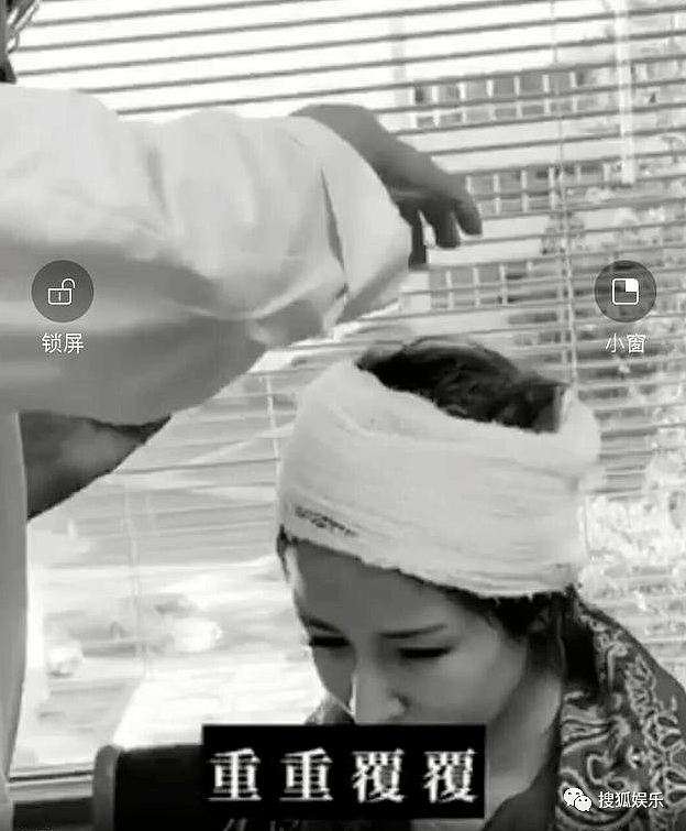 萧亚轩公开受伤照，去年拍MV意外受伤，头部受重创伤口超过5cm（组图） - 7