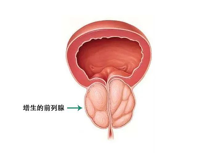 【两性】深藏不露却关乎「性福」，男性身上的它有多神奇？（组图） - 5