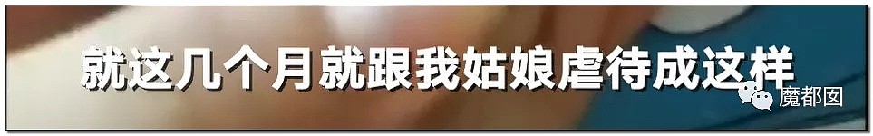 剪嘴唇、颅内出血！某音网红残忍虐待4岁继女引发全网暴怒！（组图） - 41