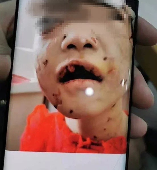 中国4岁女童被虐待事件：比起继母的歹毒，我更憎恨生父的纵容（组图） - 4