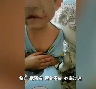 中国4岁女童被虐待事件：比起继母的歹毒，我更憎恨生父的纵容（组图） - 6