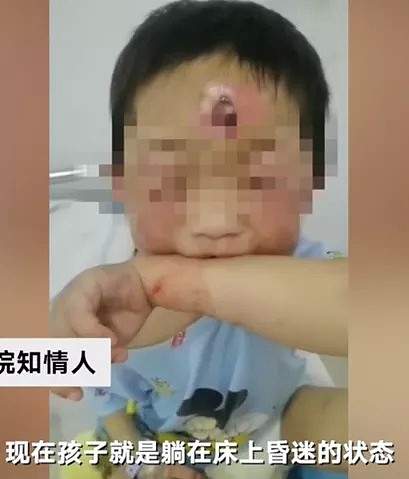 中国4岁女童被虐待事件：比起继母的歹毒，我更憎恨生父的纵容（组图） - 8