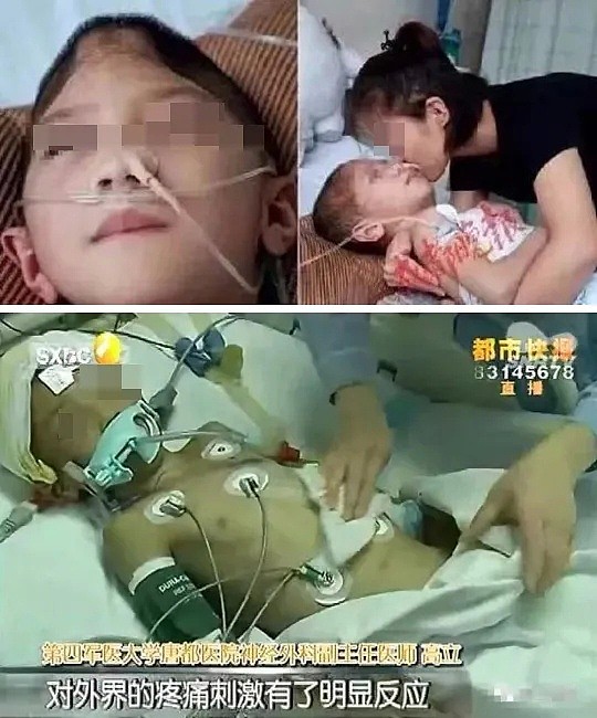 中国4岁女童被虐待事件：比起继母的歹毒，我更憎恨生父的纵容（组图） - 23