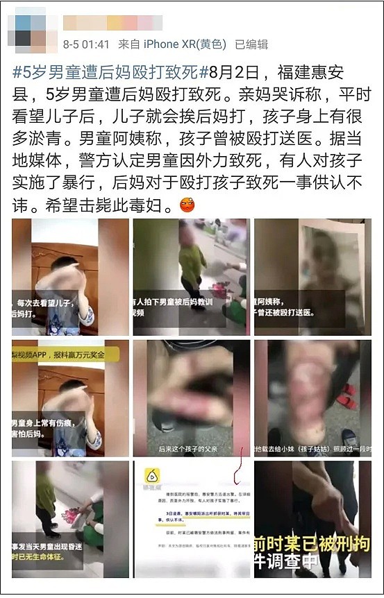 中国4岁女童被虐待事件：比起继母的歹毒，我更憎恨生父的纵容（组图） - 27