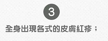 美国首例！半岁婴儿新冠并发川崎病 原来多国儿童重症是否因此诱发？（组图） - 15