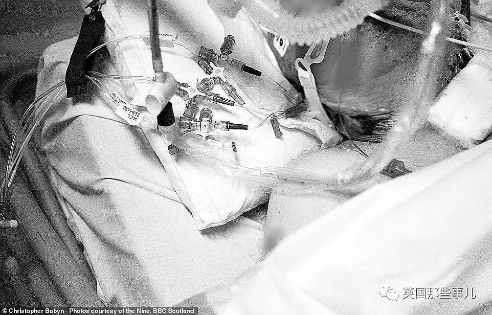 专家打脸英国日检测数据！BBC摄影师拍下ICU病房里的心碎时刻（组图） - 29