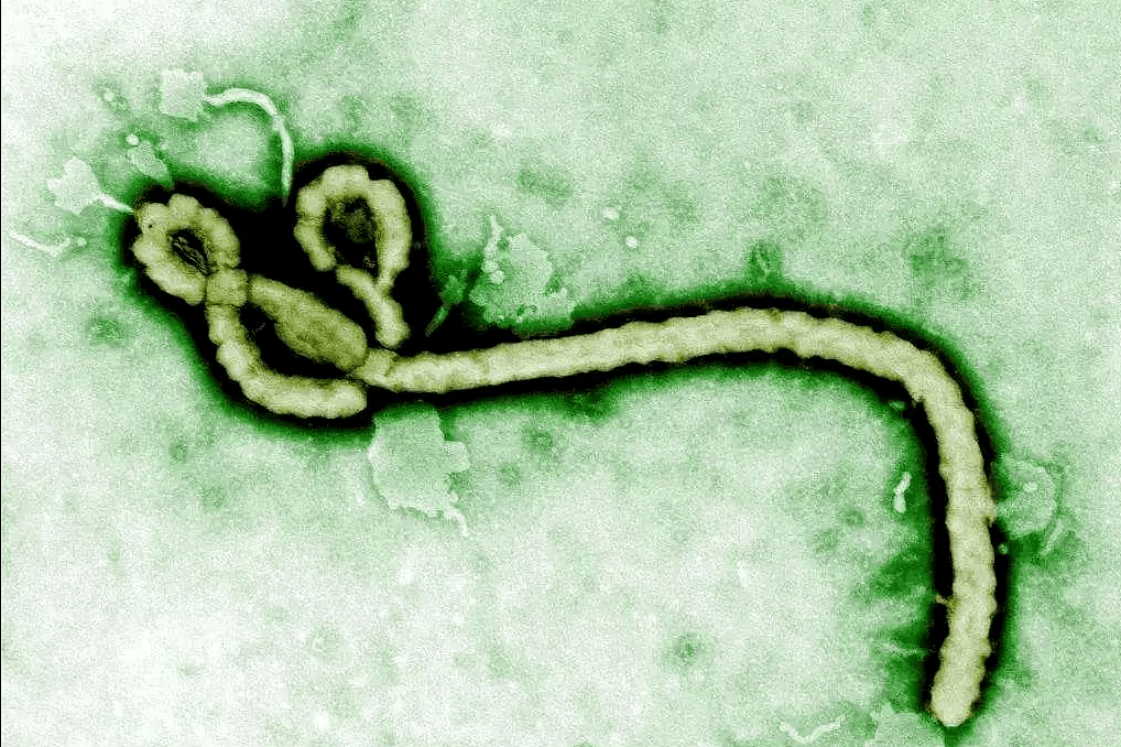 埃博拉病毒又诡异出现！1100万人爆发饥荒：非洲，已如人间地狱（组图） - 3