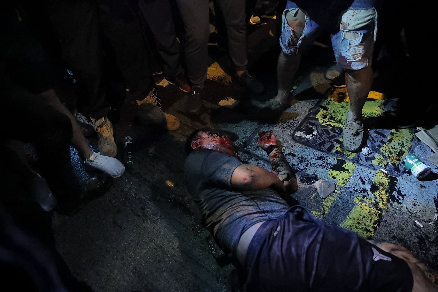 2019年11月11日，香港一名抗议者与警察发生冲突，一名受伤男子遭到抗议者袭击。(AP)