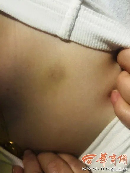 中国女孩当街遭殴打被骂“坐在宝马里哭”！女孩说“这宝马是我的”（视频/组图） - 6