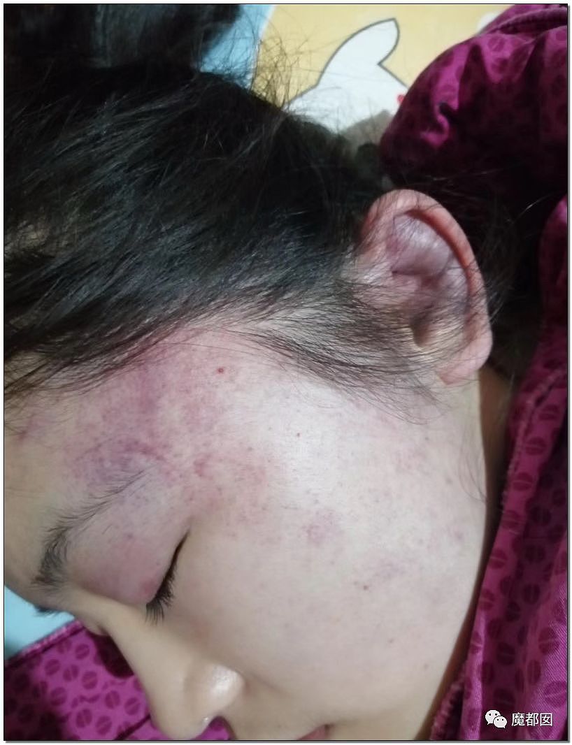 猛踢头、狠踹脸、往死里打…云南女生被围殴案件轰动全中国（组图） - 71