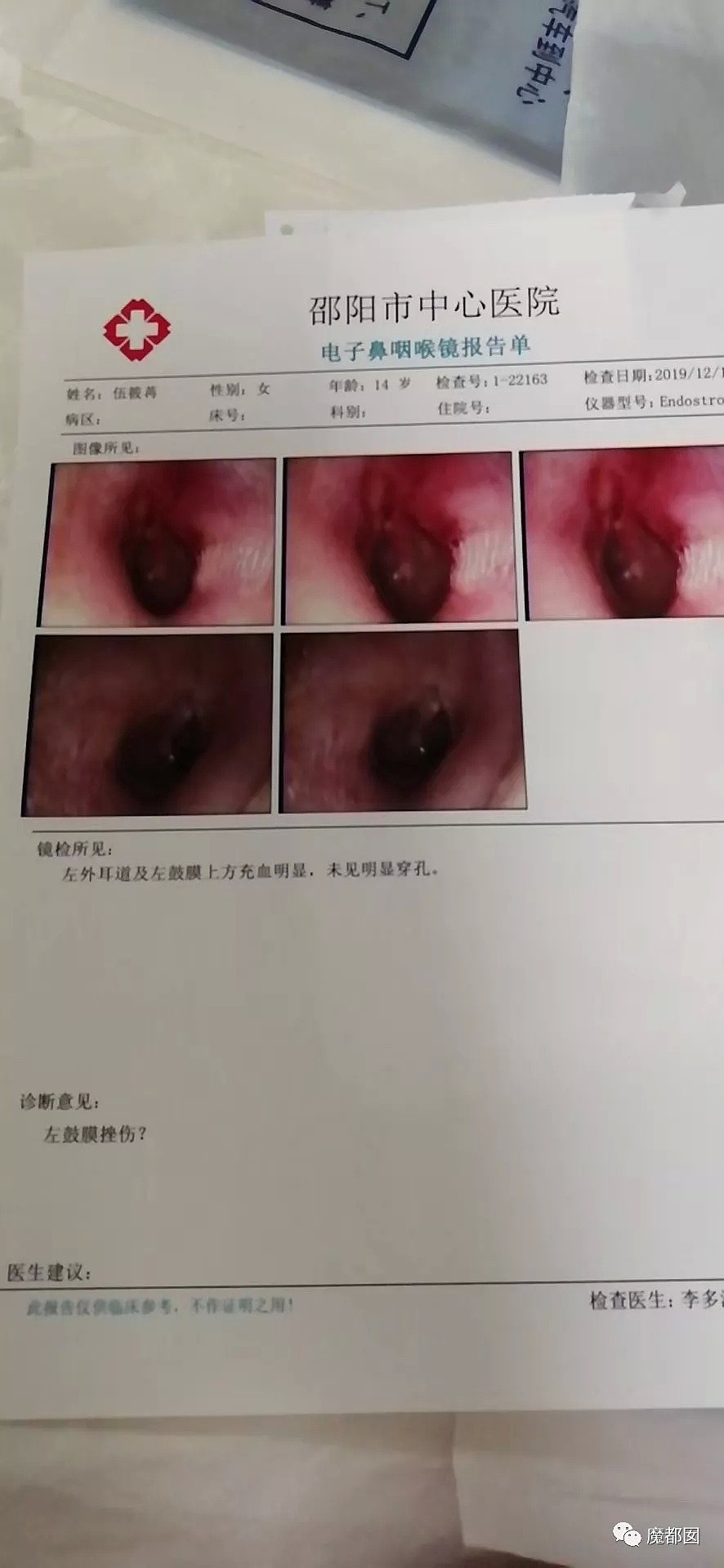 猛踢头、狠踹脸、往死里打…云南女生被围殴案件轰动全中国（组图） - 74