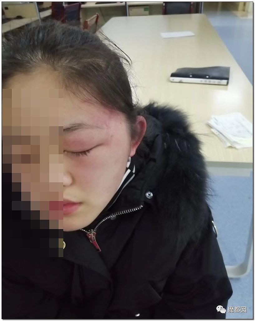 猛踢头、狠踹脸、往死里打…云南女生被围殴案件轰动全中国（组图） - 75