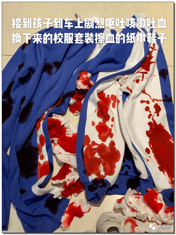 疑云密布！中国广州某小学老师体罚哮喘学生跑步，导致喷血险些致死？（组图） - 5