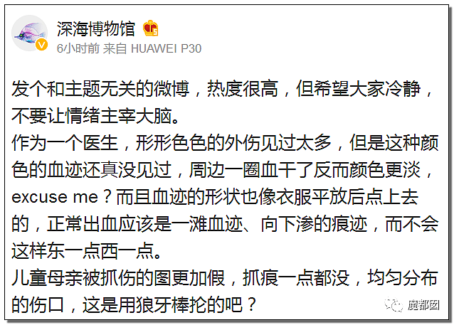 疑云密布！中国广州某小学老师体罚哮喘学生跑步，导致喷血险些致死？（组图） - 70