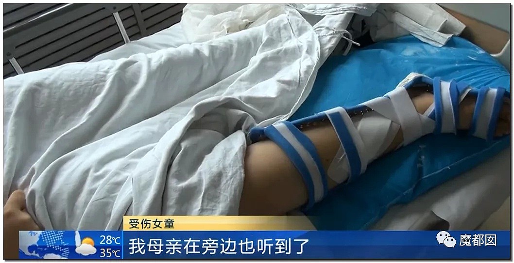 下体撕裂、骨折…这个让女研究生完全瘫痪的网红蹦床太可怕了（组图） - 82