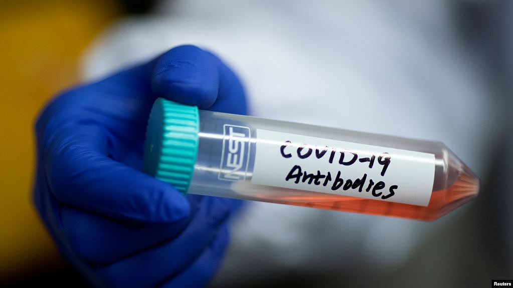 实验室研究新型冠状病毒抗体的试管。（2020年3月30日）