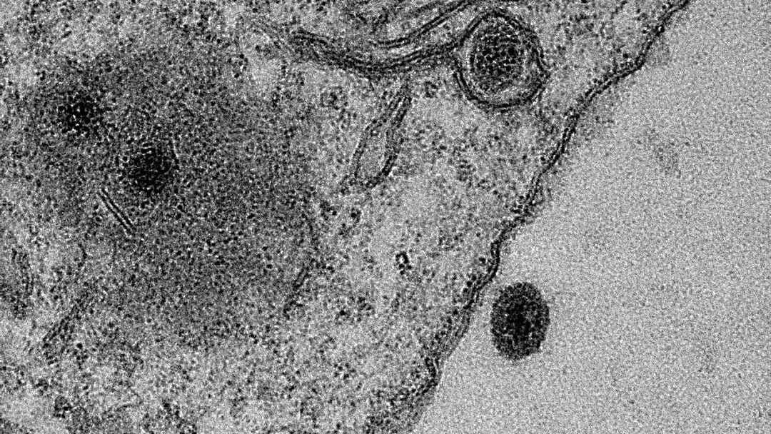 致命“僵尸病毒”卷土重来？世卫组织宣布第11轮疫情 病毒的神秘远超人类认知 - 30