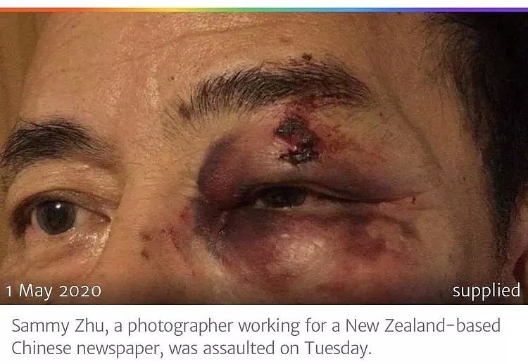 美国矛盾升级！死亡惨重，警民互相“枪杀” 华人记者被打得满脸是血…在新西兰也有一群“弗洛伊德”！（组图） - 16