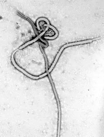 疫情下，史上最可怕的埃博拉病毒卷土重来！美国暴乱向外蔓延，2020年还能更糟吗? - 14