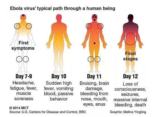 疫情下，史上最可怕的埃博拉病毒卷土重来！美国暴乱向外蔓延，2020年还能更糟吗? - 19