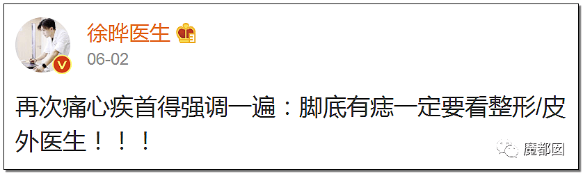 全网热议！赶紧看看你脚底和手上有无黑痣，可能会要命！（组图） - 2