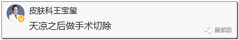 全网热议！赶紧看看你脚底和手上有无黑痣，可能会要命！（组图） - 59